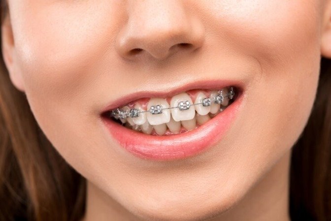 orthodontic