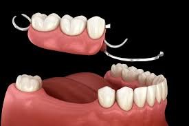 download (1) Download 1